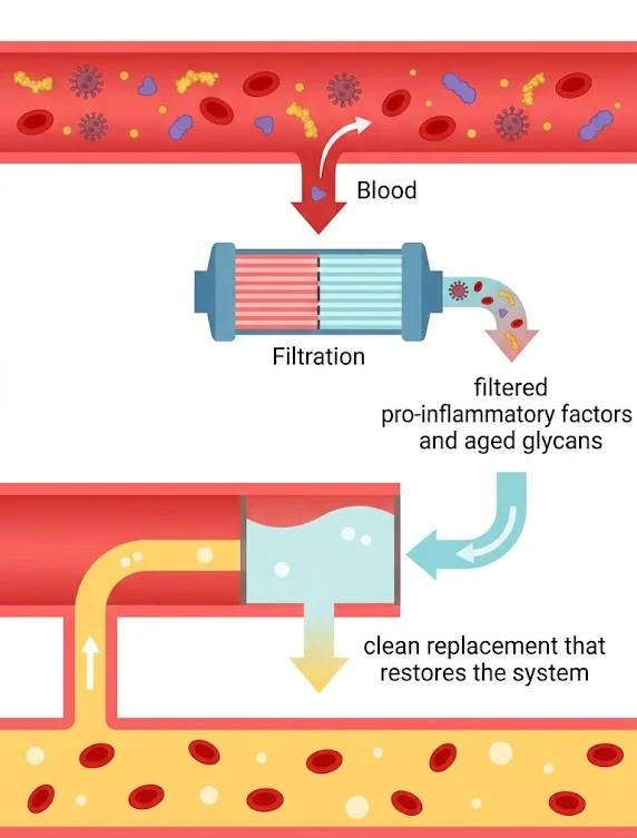 Diagram of therapeutic plasma exchange: blood flows from a vessel into a filtration device, which removes pro-inflammatory factors and aged glycans; a clean replacement fluid is then returned to the bloodstream along with the blood cells.
